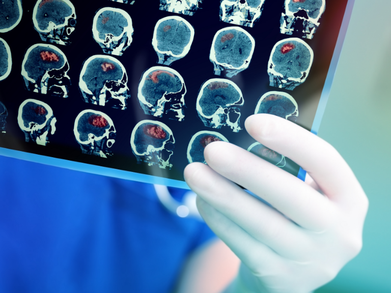 Doctor attentively examines the MRI scan of the patient