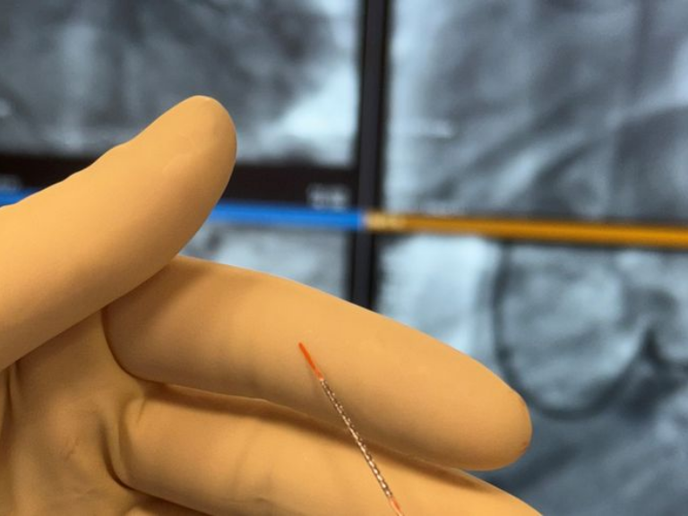 Stent in der Hand einer Person