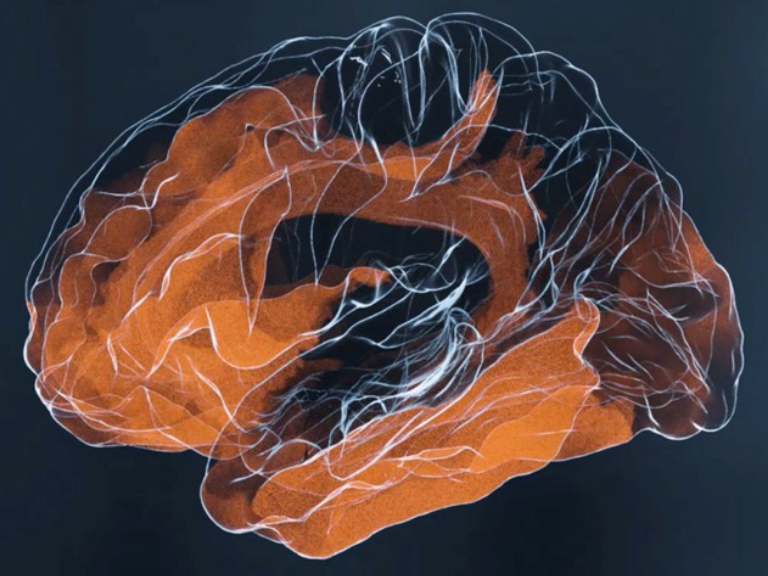 Momentaufnahme des sich ständig verändernden Signalflusses im menschlichen Gehirn