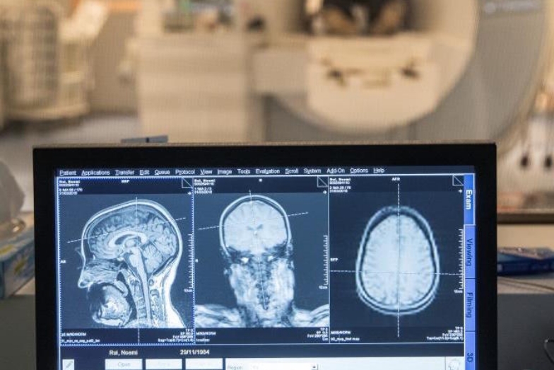 Klinische neurologische Forschung