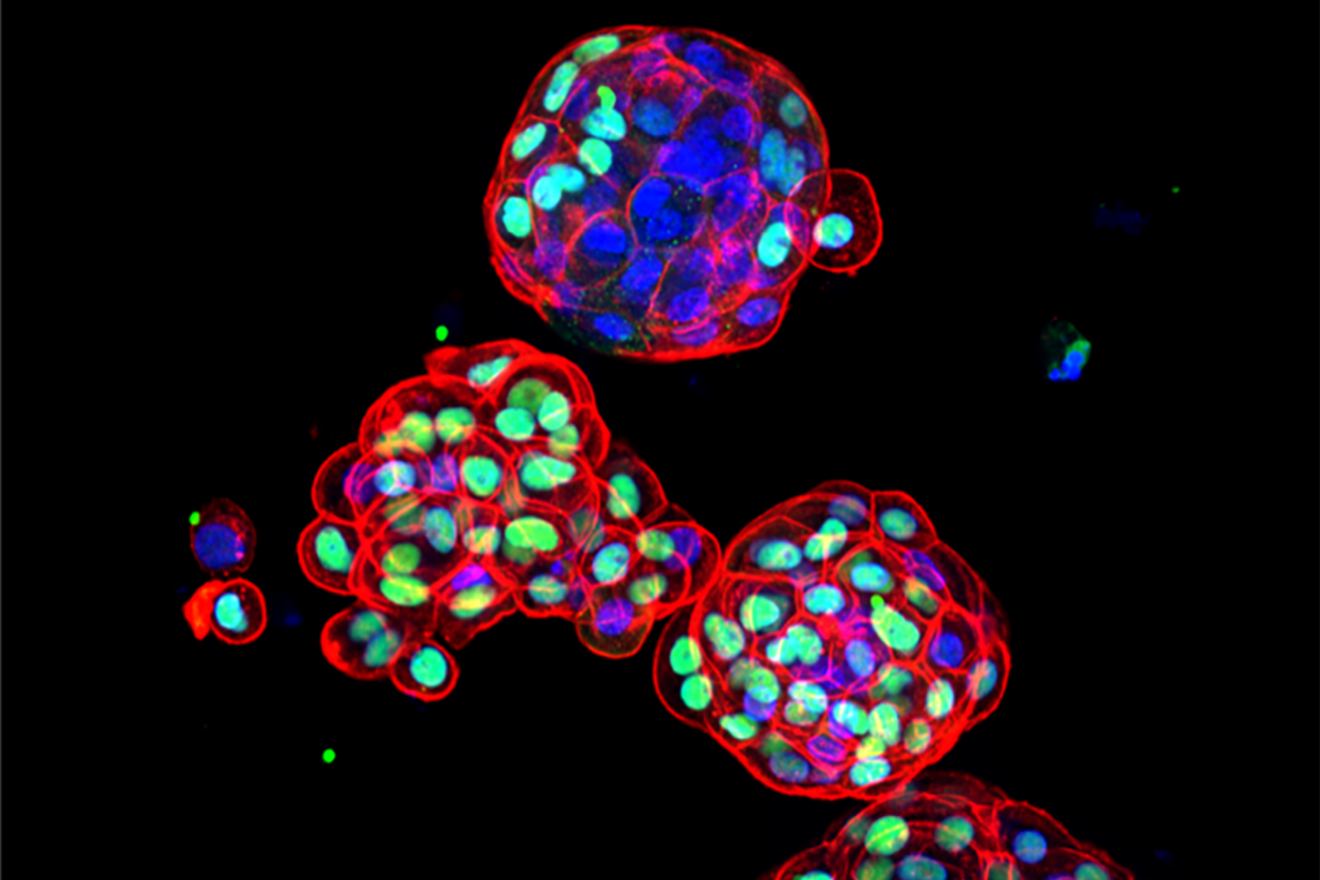 Bladder Cancer Organoids